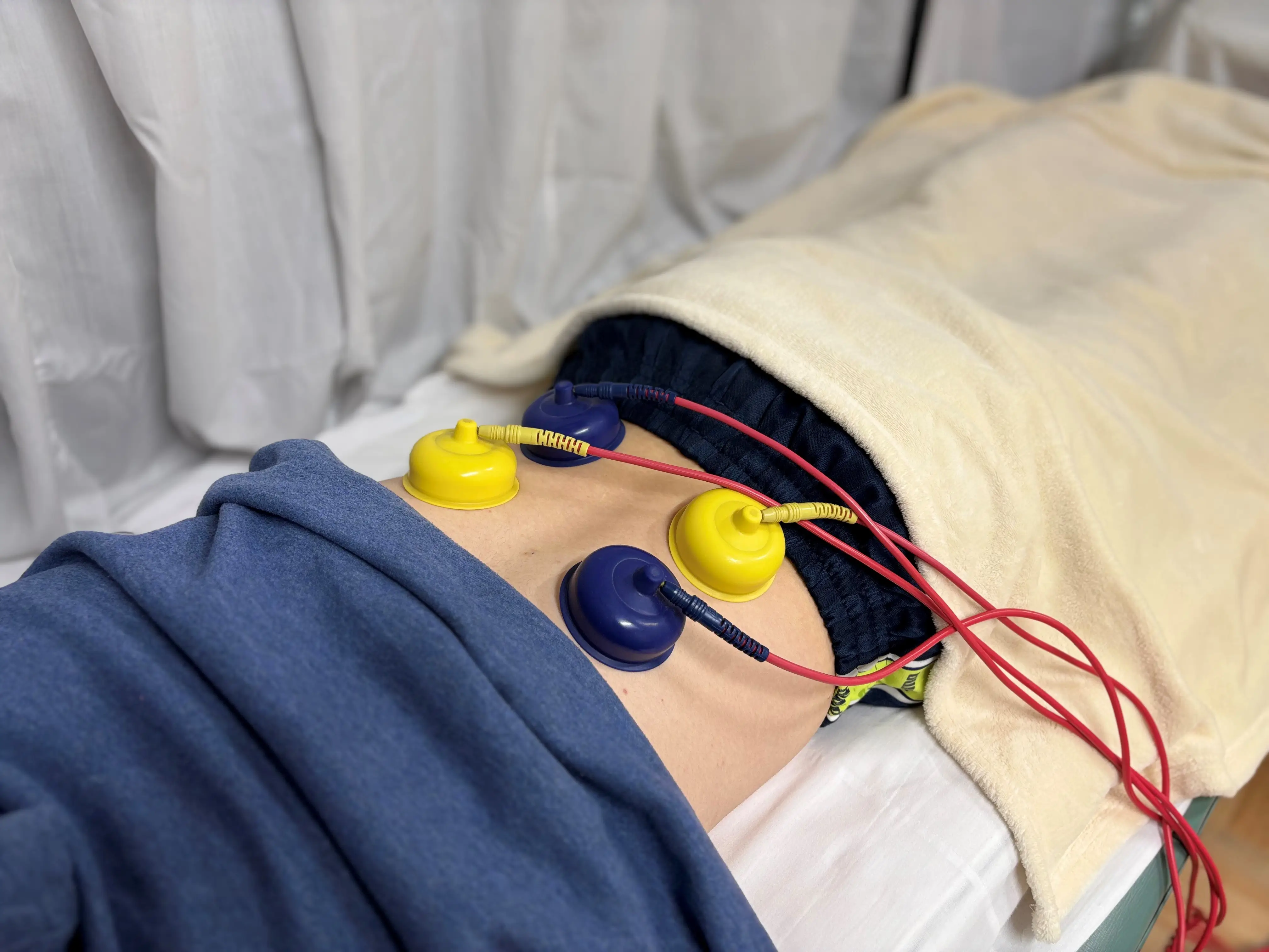 武井接骨院で使用している干渉波治療器