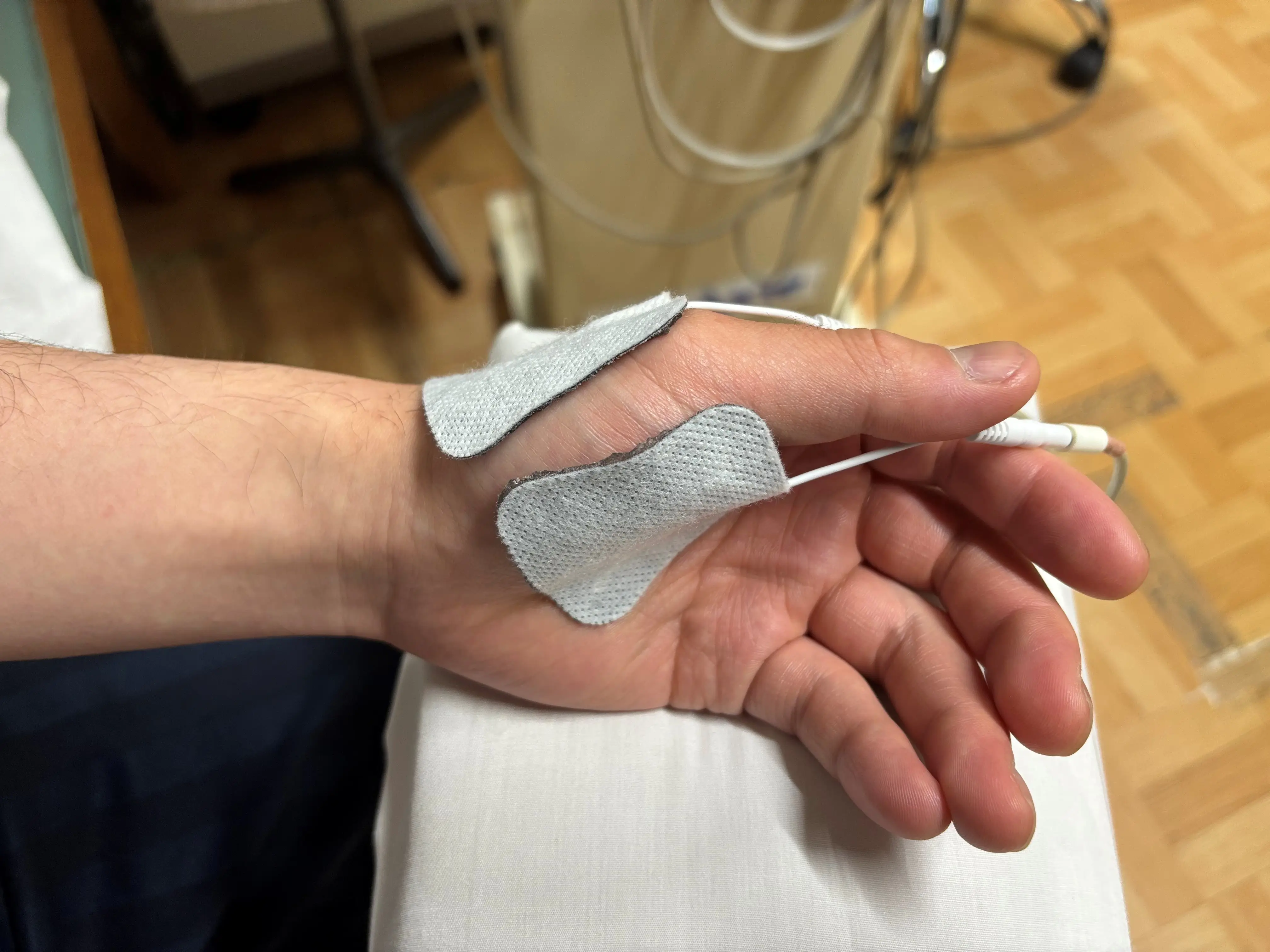 武井接骨院で使用している微弱電流治療器（ソーマダイン）