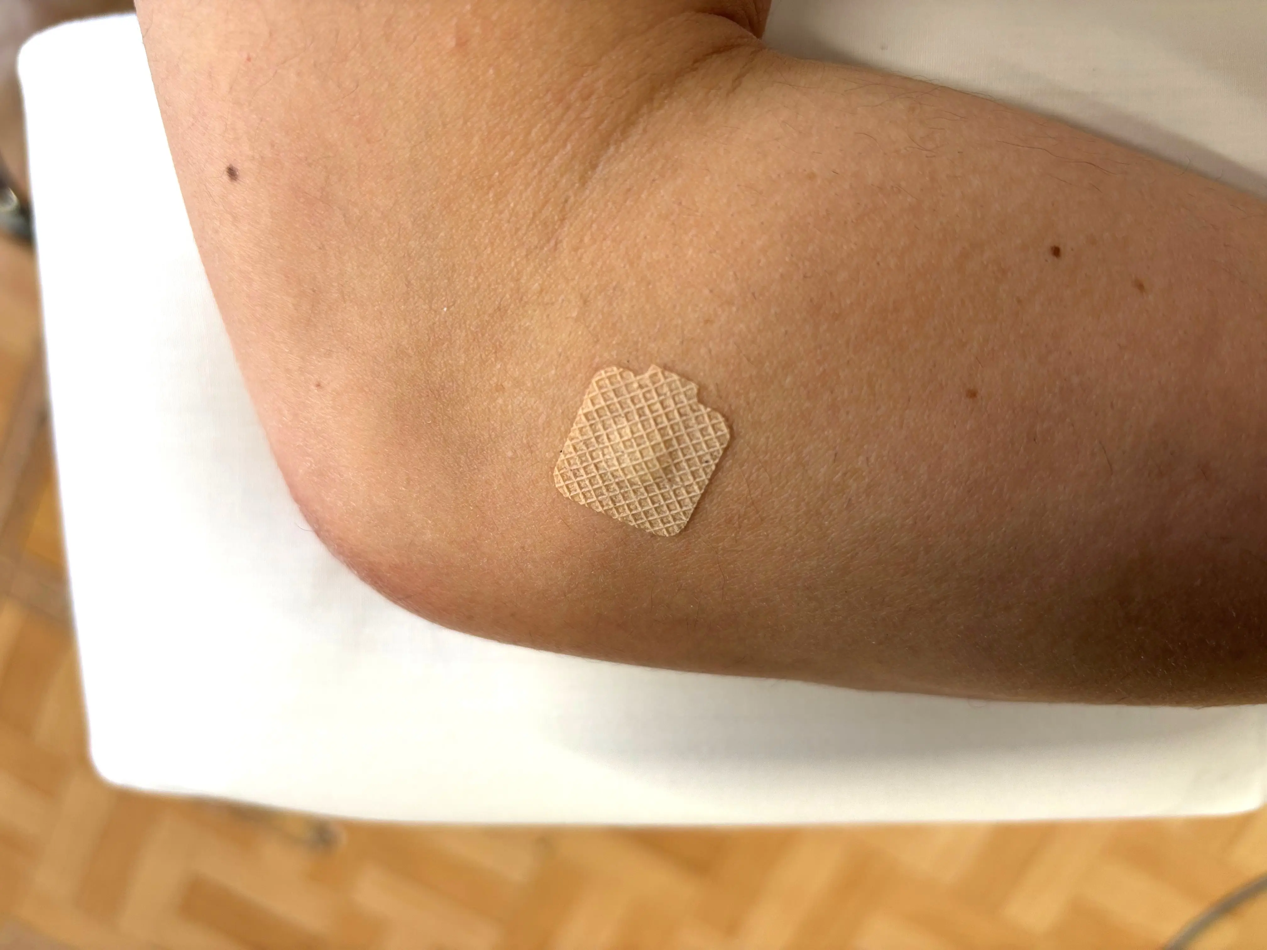 武井接骨院で使用しているソマニクス治療